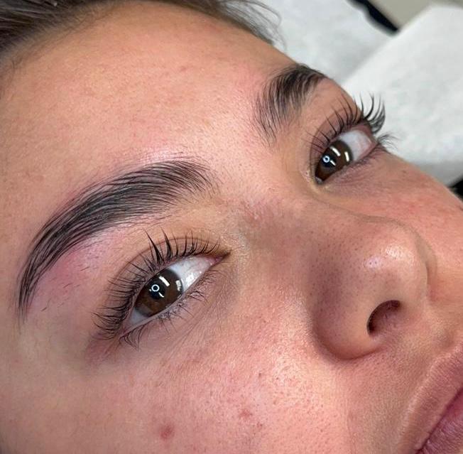 Wenkbrauwbehandeling Lumeya